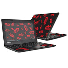 Load image into Gallery viewer, MightySkins Skin Compatible with Lenovo 100s Chromebook wrap Cover Sticker Skins Kiss Me
